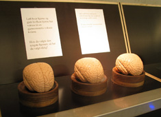 brain weight